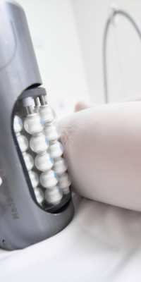 Nanoplastia Treatment